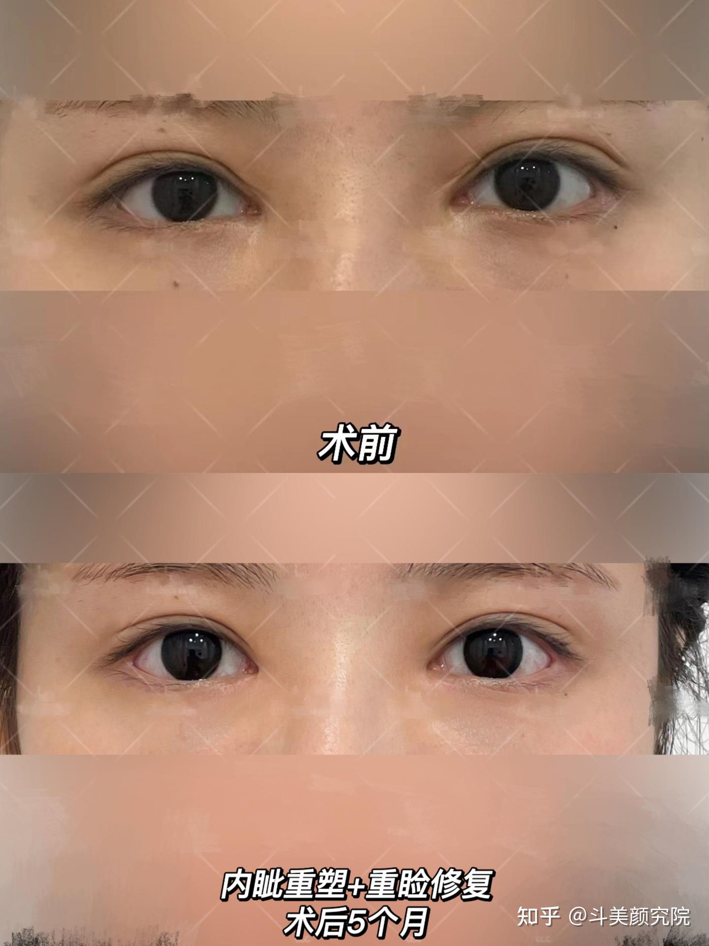 双眼皮调整-书籍-学习资料-电子书夸克网盘资源分享