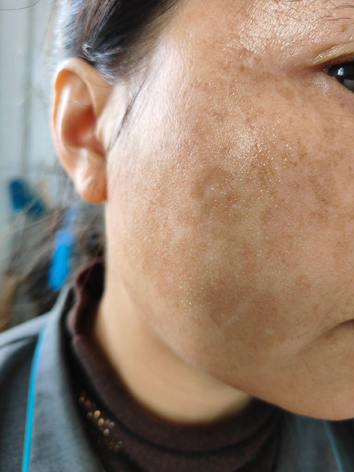 减少掉发脱发技术全套教程-书籍-学习资料-电子书夸克网盘资源分享