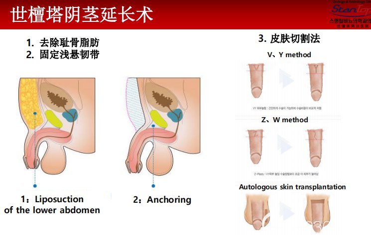 关于丁丁的增长增粗-书籍-学习资料-电子书夸克网盘资源分享